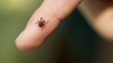 Частите по тялото, на които е най-вероятно да получим ухапване от кърлеж