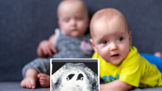 Как жената може да забременее, докато вече е бременна