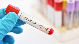 1911 положителни за COVID-19,  в Кърджали случай на репозитивиране на инфекцията