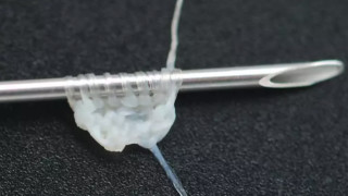 За какво служи "преждата" от човешка тъкан