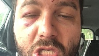 Български таксиметров шофьор в Англия е бил пребит от двама