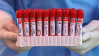 Новите потвърдени случаи на коронавирус у нас за последното денонощие