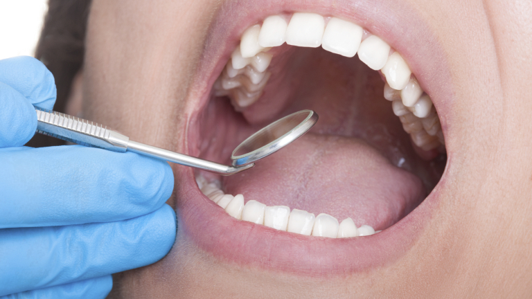 Профилактика от НЗОК иска Сдружението на зъболекарите 