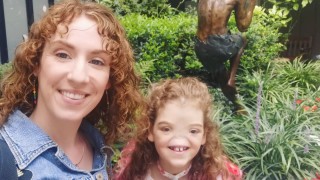 Теса е родена с необичайно заболяване известно като пълна вродена