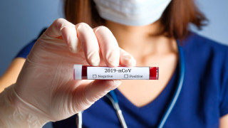 1414 са новите случаи на коронавирус у нас Направени са