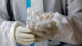 60 нови случая на коронавирус, 74 души са в интензивни отделения