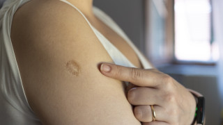 Директорът на Института за обществено здраве в Сърбия Милан Йованович