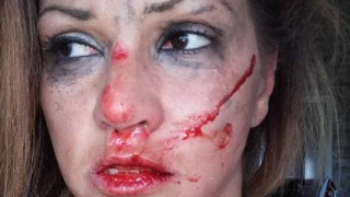 Лъже ли певицата Сани Алекса за боя?