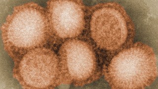 Птичи грип с щам H7N4 тръгна и по хората пише