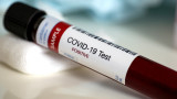 Рекорд на заразени с COVID-19 в Ирландия