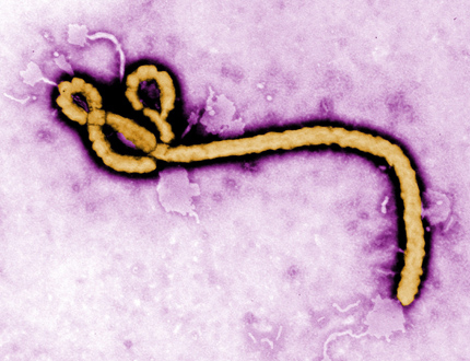 В Швеция е хоспитализиран пациент със симптоми на ебола