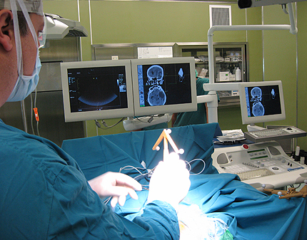 Уникален апарат за прецизни мозъчни операции заработи в „Токуда"
