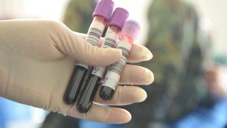 Десетки епруветки с кръв бяха открити от шофьор на автобус