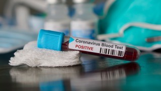 Лекар в Бургас е заразен с коронавирус