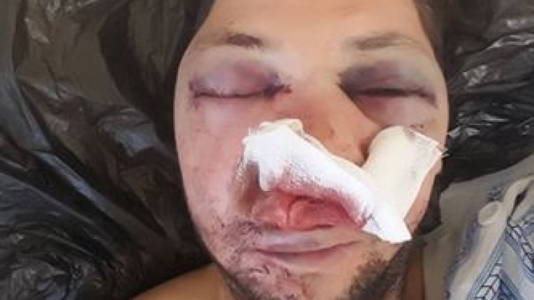 Двама с бухалки пребиха журналиста от Поморие Стоян Тончев