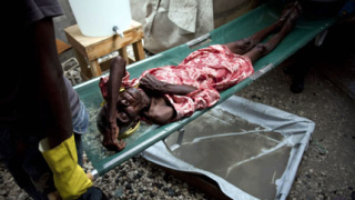 Холерата от Хаити се пренесе в САЩ