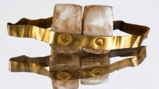 Стоматологията е един от най древните клонове на медицината който още