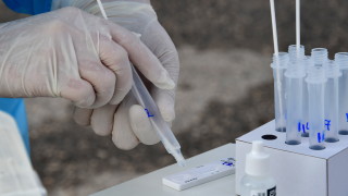 739 нови случая на коронавирус при 1965 теста, излекуваните са 815