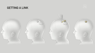 Neuralink на Мъск имплантира мозъчен чип на човек