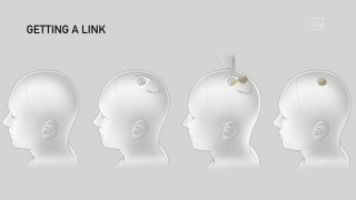 Компанията за мозъчни импланти Neuralink на Илън Мъск съобщи във