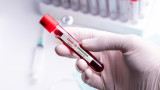 Кръвната група, резус факторът и рискът от заразяване с COVID-19