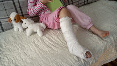 Медици в Разлог обездвижиха счупен крак на дете с... картон от пица