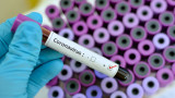  Скритите Коронавирус случаи у нас може да надвишават 15 000 още този месец 