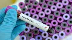 1 e новият случай на коронавирус у нас