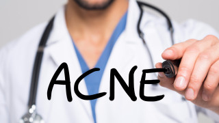 Понякога дори дерматолозите се изправят пред проблемно акне което се