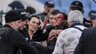 Зрението на ранената полицайка е застрашено