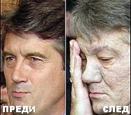 Юшченко: Москва блокира делото за моето отравяне