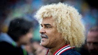 Карлос Валдерама се подложи на процедура която напълно промени визията