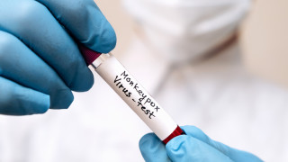 Тринадесет случая на маймунска шарка mpox са регистрирани в Сингапур