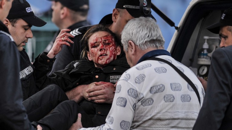 Ранената полицайка Гергана Зашева: В тази ситуация може да се озове всеки - дете, дори близък на този, който хвърля бомбичката... 