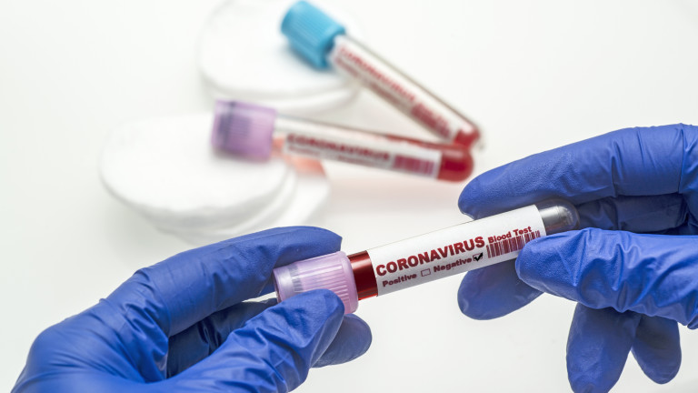 121 са новите случаи на коронавирус у нас. Направени са 3