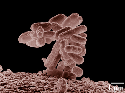 Резистентността на бактериите към лекарствата - бомба със закъснител за човечеството