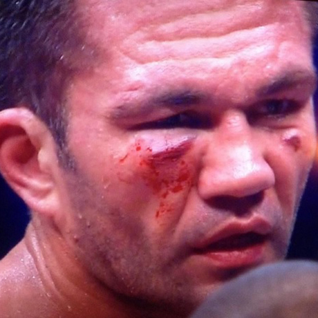 Кобрата ще иска реванш от Кличко