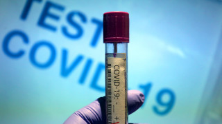 Ваксина срещу коронавируса в Япония с успешни изпитания при животни
