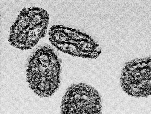 От какво ще умират хората през 2030 г.
