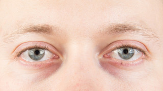 Виновниците за синдрома на сухото око