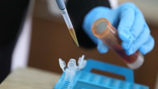 Новите случаи на коронавирус са 1237, поставени са 26 923 ваксини