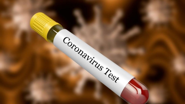 Към тази сутрин няма доказан случай на коронавирус COVID-19 в