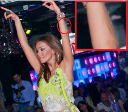 Галена се появи с белези на участие