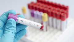 Неваксинираните с ХИВ - до четири пъти по-застрашени от дълъг COVID-19