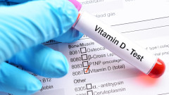 Страдаме ли от недостиг на витамин D