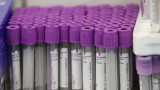 81 новозаразени и 318 излекувани от коронавирус за денонощие 