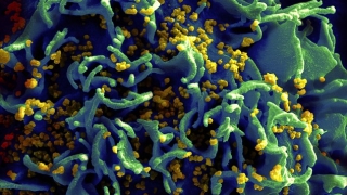 Учени разкриха къде и кога се е заразил първия човек със СПИН