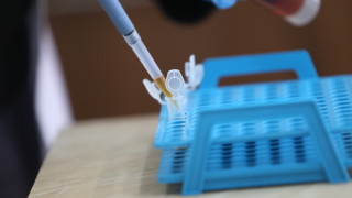 В световен мащаб са докладвани няколкостотин случая на хепатит с