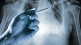 Цигарите, ракът и “магическото” възстановяване на дробовете след отказване 