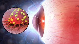 Диагнозата рак е шок за всеки пациент особено когато